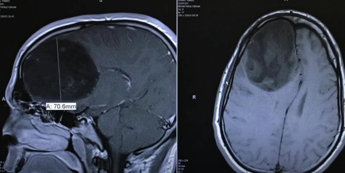 Jacob Cox hospital scans