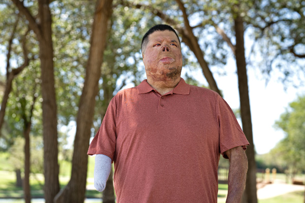 Marine Veteran Reclaims His Life After Combat Injuries