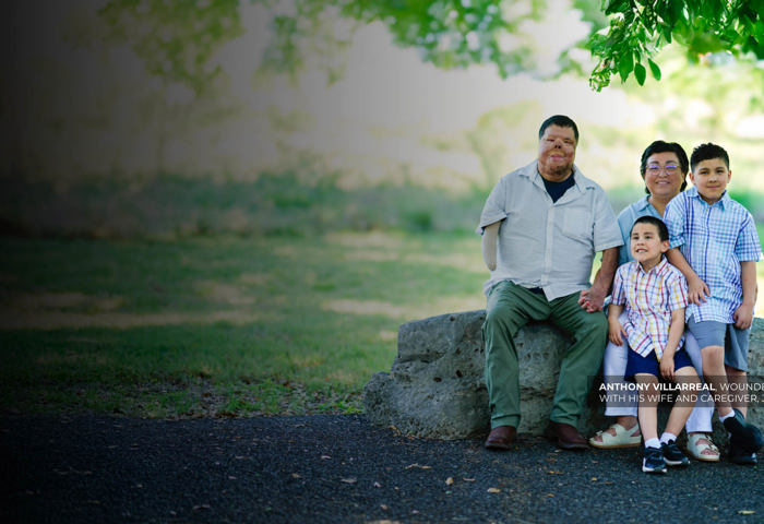 Warrior Anthony Villarreal sits with his wife & two sons under a tree. He has burn scars & his right arm amputated below elbow.