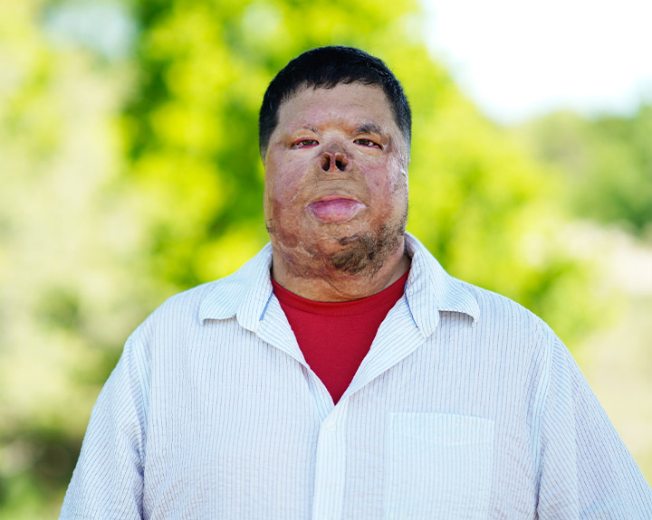 El guerrero herido Anthony Villareal se encuentra sobre un fondo borroso de árboles con una sonrisa sutil.