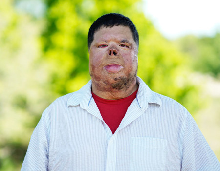 Wounded warrior Anthony Villareal stands against a blurred background of trees with a subtle smile.