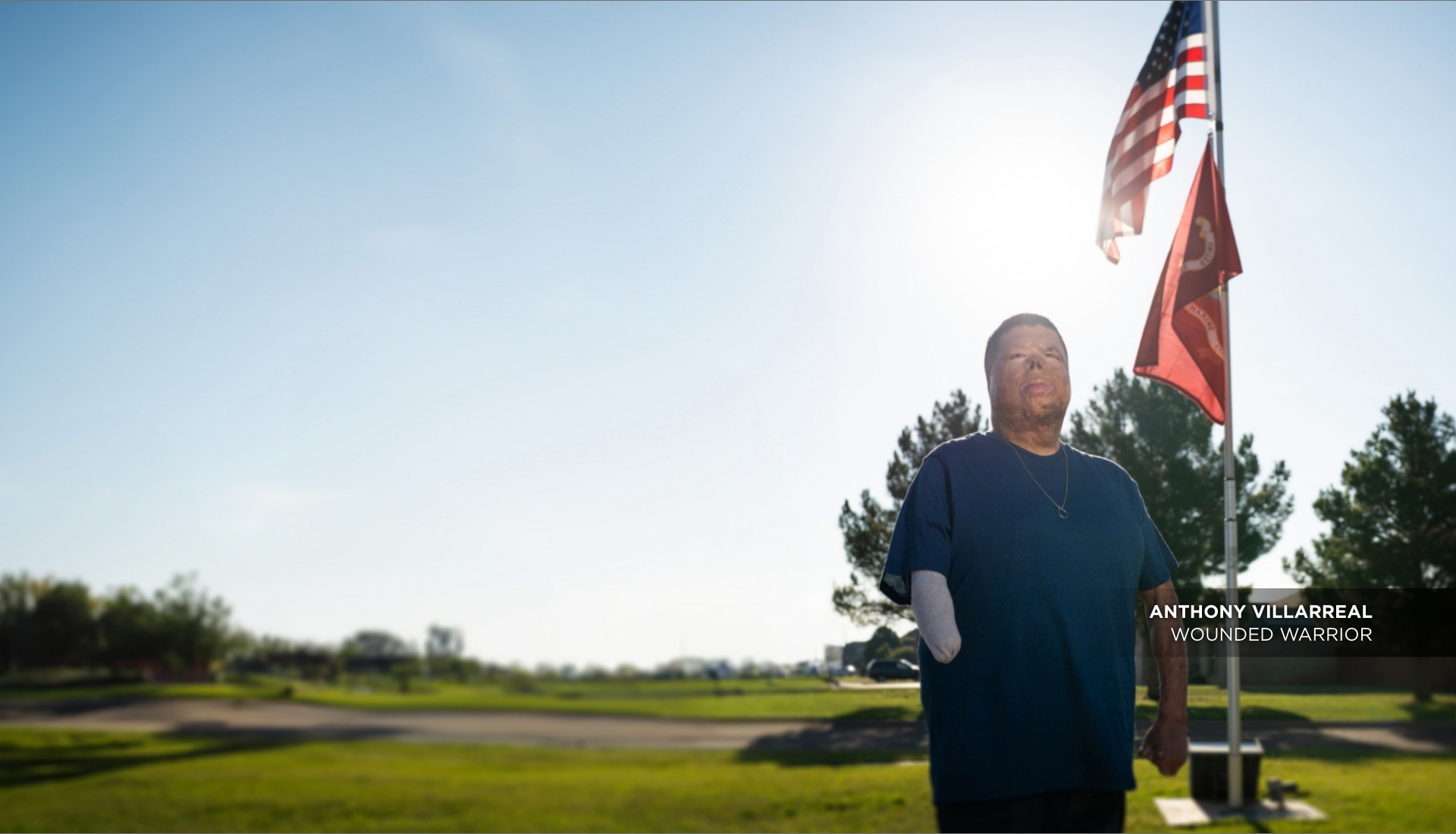 Wounded warrior with burn injuries and an amputated right forearm looks to the sky in front of an American flag.