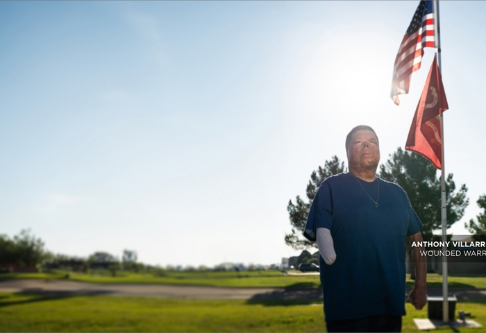 Wounded warrior with burn injuries and an amputated right forearm looks to the sky in front of an American flag.