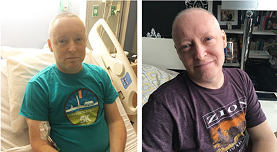 Veteran Andrew Myatt after two weeks of treatments for leukemia (left) and nine months into his cancer treatment (right).