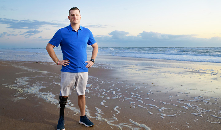 El veterano Mike Larson se encuentra en una playa al atardecer, mostrando con orgullo su pierna protésica con confianza y orgullo.