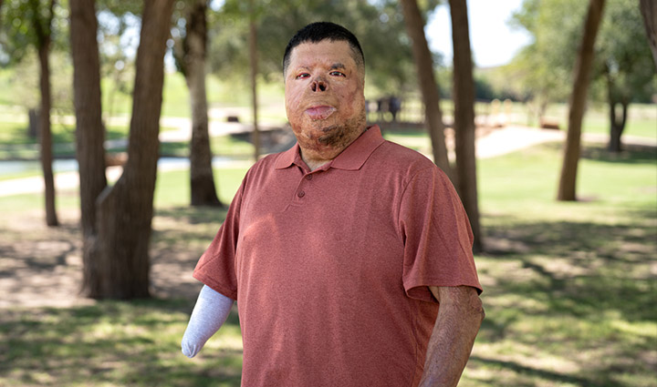 El veterano herido Anthony Villareal está afuera, vestido con un polo rojo y sonriendo a la cámara.